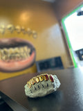2 top side and Fang & 6 bottom Dental