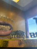 6 top dental grillz