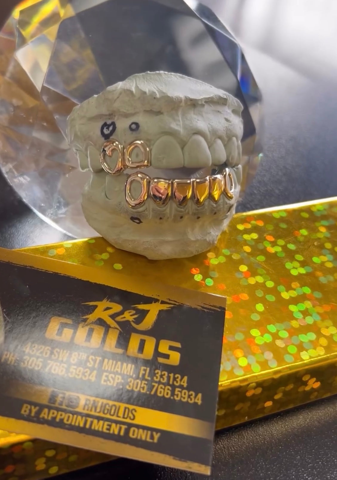 2 top side and fang dental