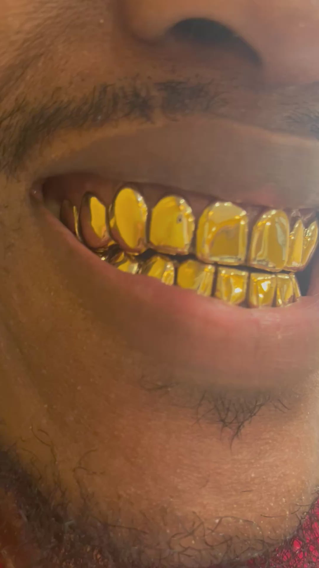 12 top & 12 bottom dental