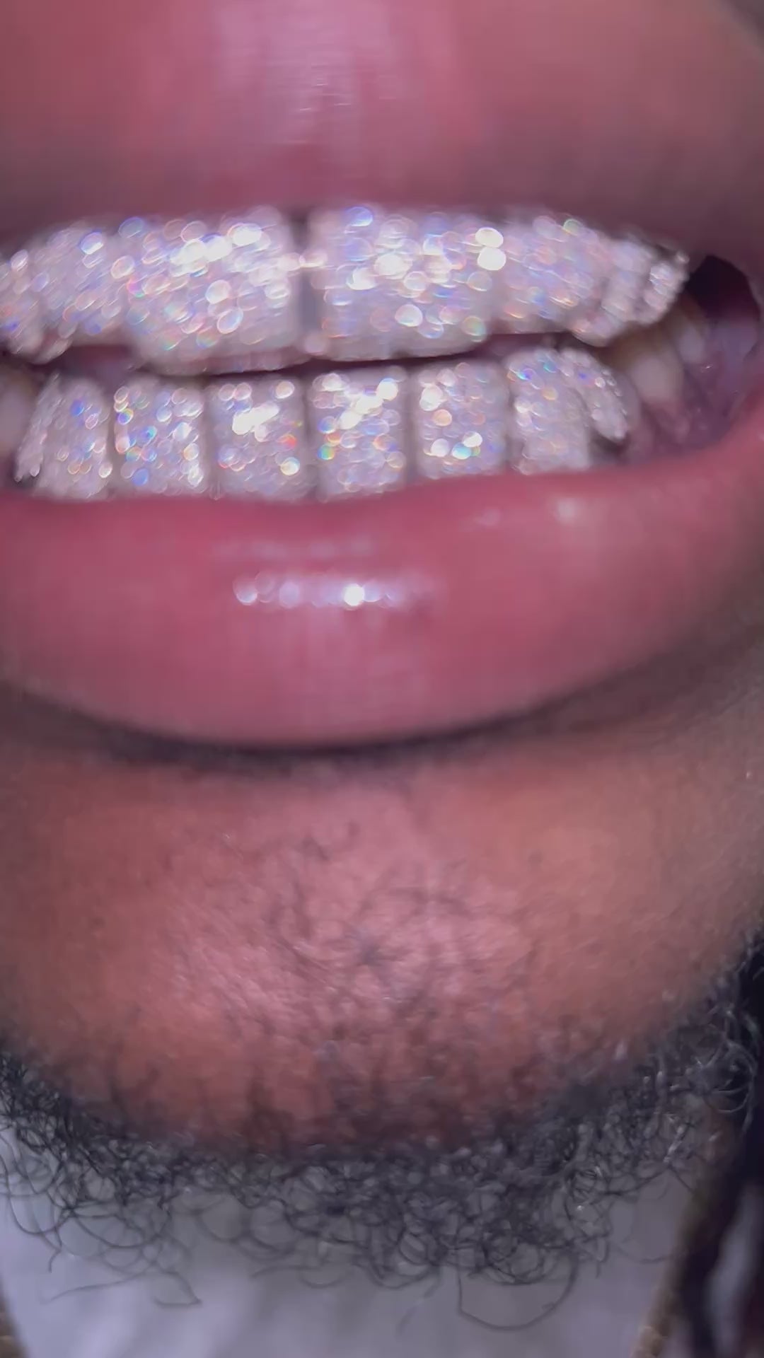 VVS Mossi SALE Grillz