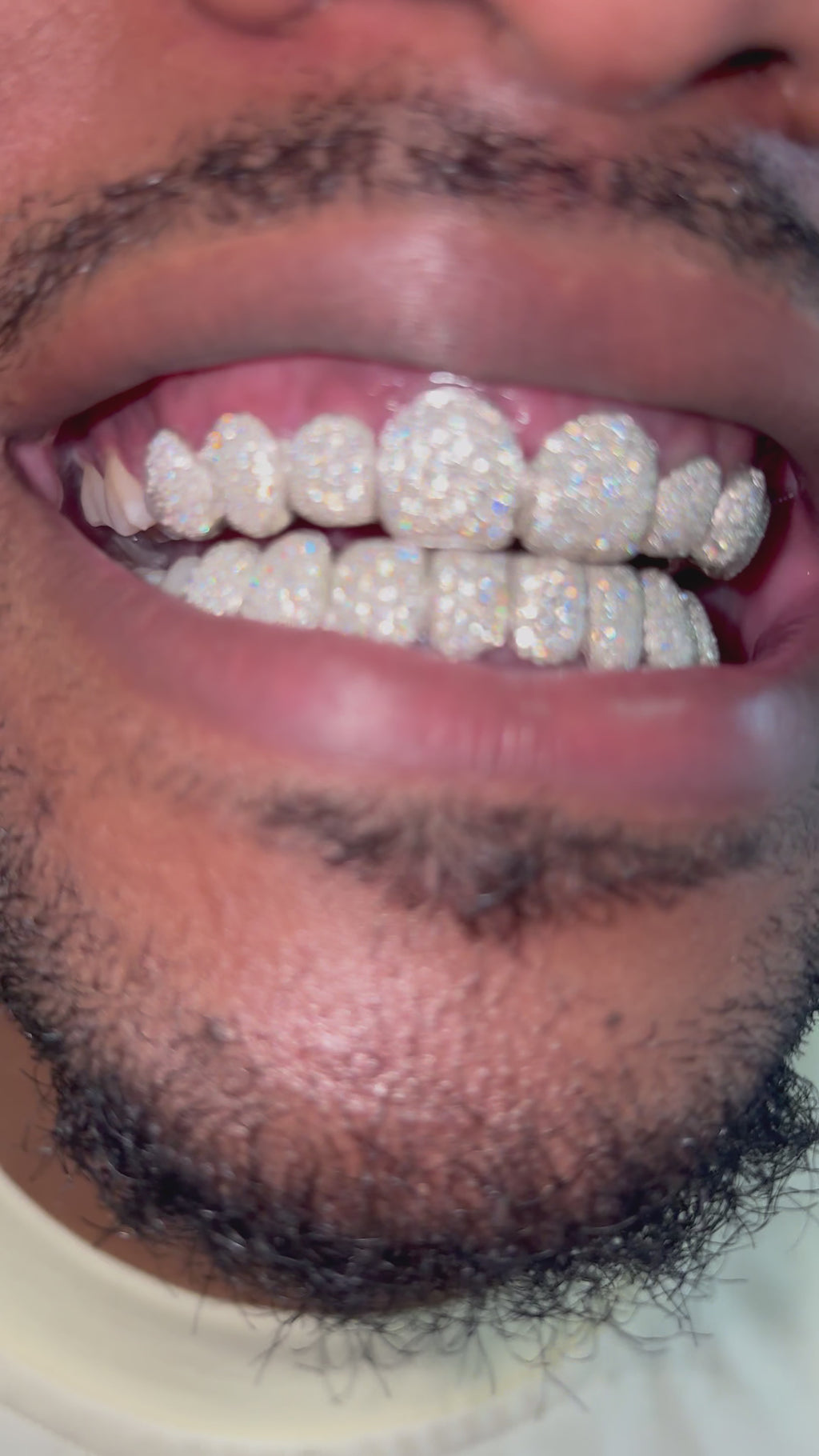 VVS Moissanite Custom Grillz